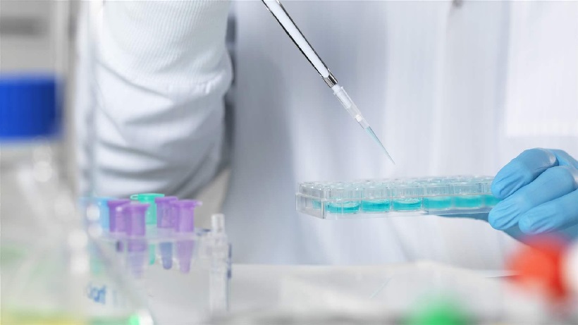Diagnostic test